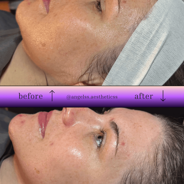 Facial & Lash Perm at Angels Aesthetics ABQ in Albuquerque, NM